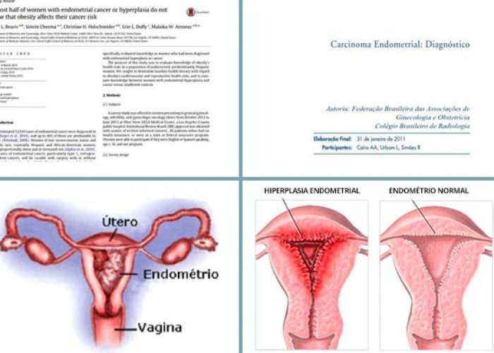 cancer-endometrio-obesidade