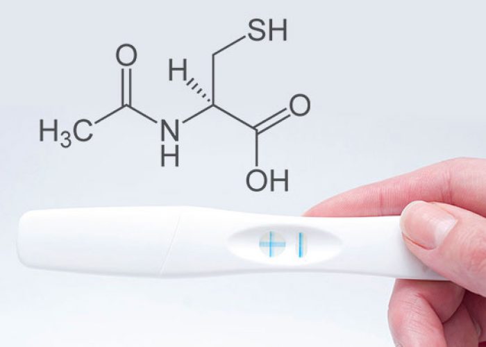 post-n-acetylcysteine